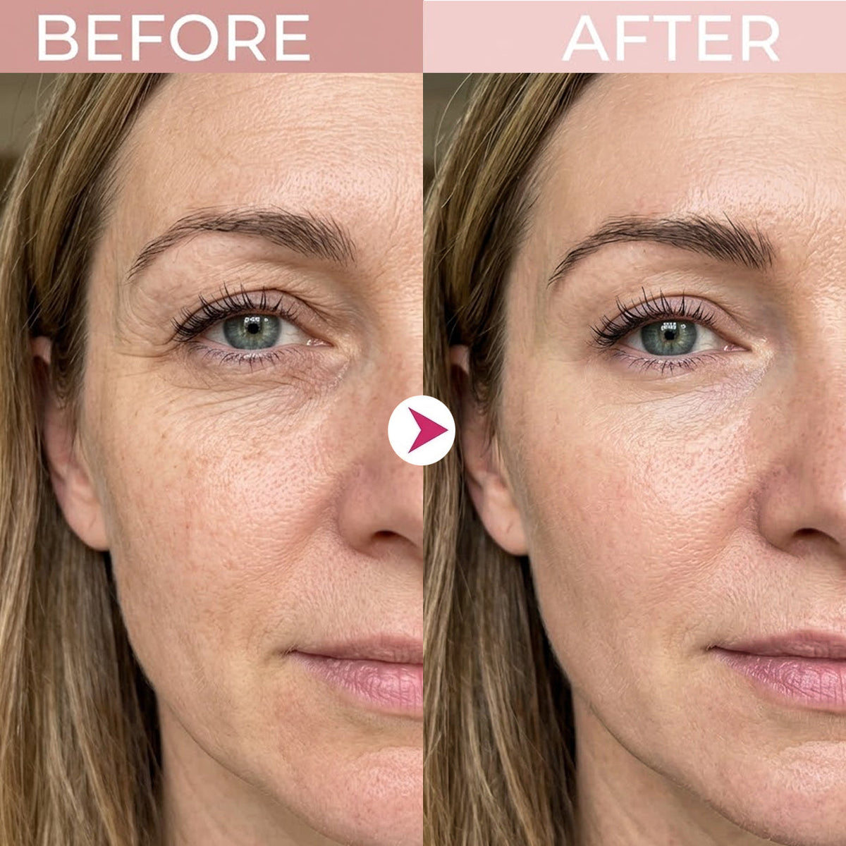 Advanced Eye Renewal Crème